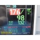 GE Dash 3000 Series Monitor &New Leads~37170