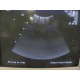 GE 548c Model 2197483 3.0- 8.0 MHz Convex Probe for Logiq 700 series (5978 )