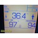 Welch Allyn 45NT0 Spot Vital Signs LXi Monitor W/ Battery & Leads ~ 37854