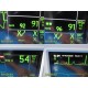 GE Dash 3000 (NBP,Temp,SpO2,ECG,CO2 Print) Patient Monitor W/ NEW Leads ~ 37859
