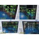 GE Dash 3000 (NBP,Temp,SpO2,ECG,CO2 Print) Patient Monitor W/ NEW Leads ~ 37859
