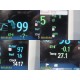 2004 Philips MP30 (M8002A) Patient Monitor W/ MMS Module & NEW Leads ~ 37837