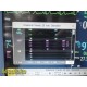 2004 Philips MP30 (M8002A) Patient Monitor W/ MMS Module & NEW Leads ~ 37837