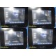 BD Sight Rght Hal Cyon Diagnostic Ultrasound System W/ L7SVA Probe & Stand~37773