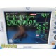 GE Dash 3000 Patient Monitor ~ 37883