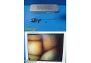 Smith & Nephew Dyonics 3628 Rigid Video Arthroscope W/ Case ~ 37881