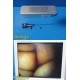 Smith & Nephew Dyonics 3628 Rigid Video Arthroscope W/ Case ~ 37881