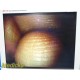 Smith & Nephew Dyonics 3628 Rigid Video Arthroscope W/ Case ~ 37881