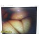 Smith & Nephew Dyonics 3628 Rigid Video Arthroscope W/ Case ~ 37881