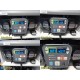 SURGICAL HD Endoscopy Tower W/ CCU OLED Light HD Camera ~ 36261