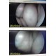 SURGICAL HD Endoscopy Tower W/ CCU OLED Light HD Camera ~ 36261