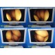 SURGICAL HD Endoscopy Tower W/ CCU OLED Light HD Camera ~ 36261