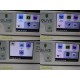 HD Arthroscopy Tower System W/ Camera Control OLED Light Source~ 36258