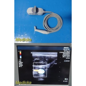 https://www.themedicka.com/23634-292393-thickbox/2015-zonare-l14-5sp-linear-hockey-stick-ultrasound-probe-ref-84008-30-37937.jpg