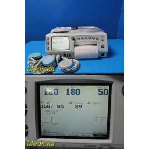 https://www.themedicka.com/23834-295561-thickbox/ge-model-259a-maternal-fetal-monitor-2x-us-toco-probes-event-clicker-38092.jpg