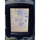 Welch Allyn 450T0 Spot Vital Signs LXi Monitor W Battery Leads 38067