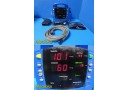 GE Dinamap ProCare 2009613-001 VitalSigns Monitor W/ Leads NEW Battery 38681