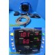 GE Dinamap ProCare 2009613-001 VitalSigns Monitor W/ Leads NEW Battery 38681