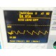 ZOLL M-Series Defibrillator