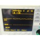 ZOLL M-Series Defibrillator