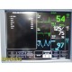 2013 GE DASH 4000 Patient Monitor | ECG NIBP SpO₂ Temp NIBP | 2X Batteries~38646