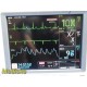 2013 GE DASH 4000 Patient Monitor W/ 2x Batteries & NEW Patient Leads ~ 38253
