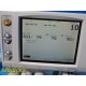 GE Corometrics 259A Fetal/Maternal Monitor W/ US+Toco Transducer & Leads ~ 38676