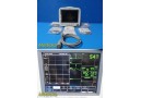 GE Dash 4000 Monitor (T/CO, SpO2, ECG, NBP, Print) W/ Batteries & Leads ~ 38677