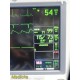 GE Dash 4000 Monitor (T/CO, SpO2, ECG, NBP, Print) W/ Batteries & Leads ~ 38677