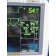 GE Dash 4000 Monitor (T/CO,SpO2,ECG,NBP,Print) W/ NEW Leads & Batteries ~ 38678