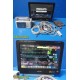 2017 Philips IntelliVue MX700 + X2 + M3012A Monitoring System W/ New Leads~38787