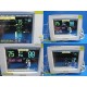 Philips IntelliVue MP30 Monitor W/ MMS+Hemodynamic Module, Batteries,Leads~38805