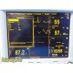 Datascope Passport 2 Monitor (ECG NIBP SpO₂ Temp) W/ Leads & Printer ~ 38819