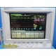 Philips/Agilent VARIDIA 24C/26 Anesthesia Monitor W/ M1041A Rack+7 Modules~38868