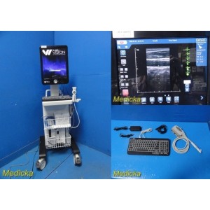 https://www.themedicka.com/24534-306458-thickbox/site-rite-vision-ii-ultrasound-w-40mm-linear-probe-cart-keyboard-38973.jpg