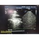 Philips S7-3T TEE Transesophageal Ultrasound Probe 453561181214 W/ Case ~ 39019