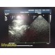 Philips S7-3T Pediatric TEE Ultrasound Probe Transducer W/ Case ~ 39022