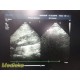 Philips S5-1 Sector Ultrasound Probe Ref 453561176742 | Tested on iE33 ~ 39009