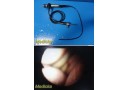 Olympus BF Type 1T40 Broncho Flexible Scope w/ Integrated Light Cable~39501
