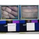 Smith & Nephew 350 3-CCD Endoscopy Camera System w/ ED-3 Camera Head ~ 39607