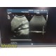 Philips C5-1 PureWave Convex Ultrasound Probe | Tested on iU33 | Working ~ 39215