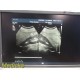 Philips C5-1 PureWave Convex Ultrasound Probe | Tested on iU33 | Working ~ 39215