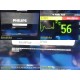 2019 Philips IntelliVue MX450 Monitor w/ MMS+Hemodynamic Modules & Leads ~ 39187