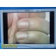 2012 Stryker 26" Vision Elect Ref 240-030-960 HDTV Surgical Monitor ~ 39192