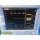 Datascope Passport 2 Patient Monitor w/ ECG NIBP SpO₂ Accessories & Mount ~39693