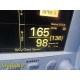 Datascope Passport 2 Patient Monitor w/ ECG NIBP SpO₂ Accessories & Mount ~39693