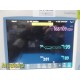 Philips Intellivue MP30 Monitor W/ MMS + Extension Module & Leads ~ 38358