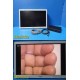 Olympus OEV261H HD Medical Endoscopy LCD Monitor w/ VEKON56 AC Adapter ~ 39831