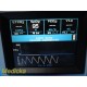 2017 Philips NM3 Respiratory Profile Monitor W/O Module & Sensor or Leads ~ 33057