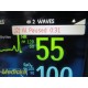 2015 Philips IntelliVue MP5 M8105A Monitor ECG SpO2 NIBP w/ NEW Leads ~ 39249